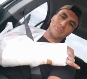 ON ICE: Albury halfback Shannon Bradbrook re-broke his wrist trying to keep on top of his fitness for the delayed Group Nine season.