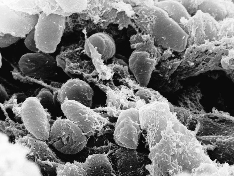 The ancient strain of Y pestis was likely to have been less deadly than its medieval version.