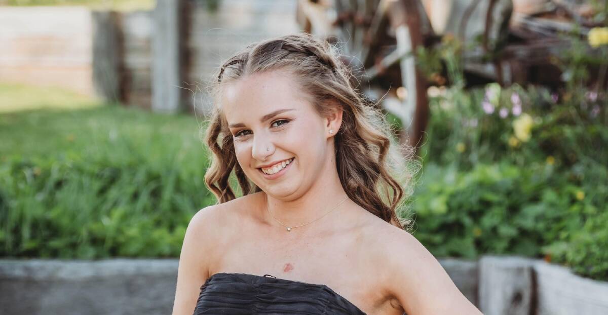 BRAVE FACE: Kelly Duffy, 18, from Tumbarumba is "very grateful" for the support from her local community following her recent leukaemia diagnosis. Picture: Supplied.
