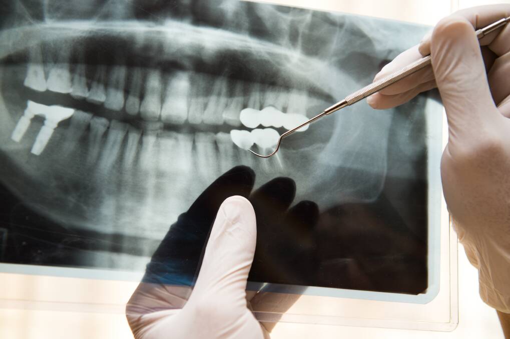 Oral and maxillofacial surgeons hold dental and medical degrees and their work includes wisdom teeth to facial trauma cases.