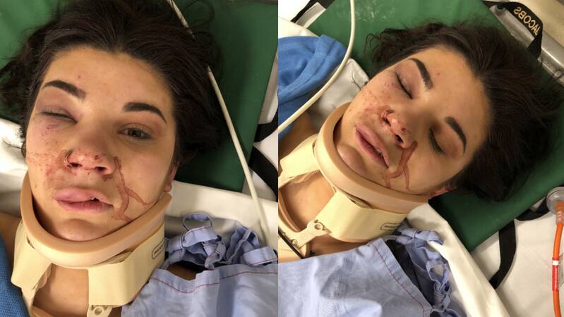 SET UPON: Makayla Hopkins-Windle was allegedly attacked at Bolton park on Thursday afternoon. Picture: supplied