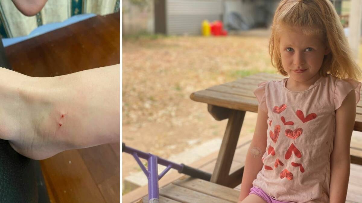 Natalie Willis, 5, has recovered from a dry snake bite. The shocking event has prompted her mum, Edwina, to urge everyone to be on the lookout as snakes creep closer to homes. 
