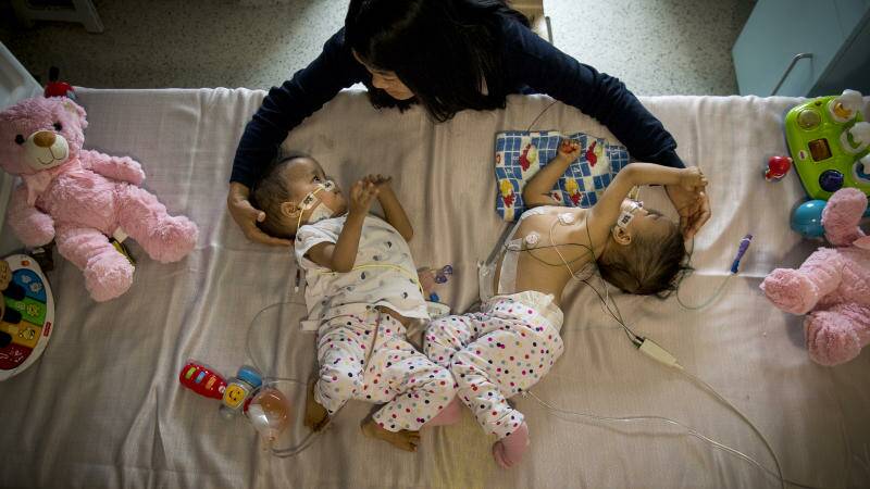 Separated Bhutanese twins Nima (right) and Dawa with their mother Bhumchu Zangmo recovering after their surgery at the Royal Children Hospital. Photo: Eddie Jim