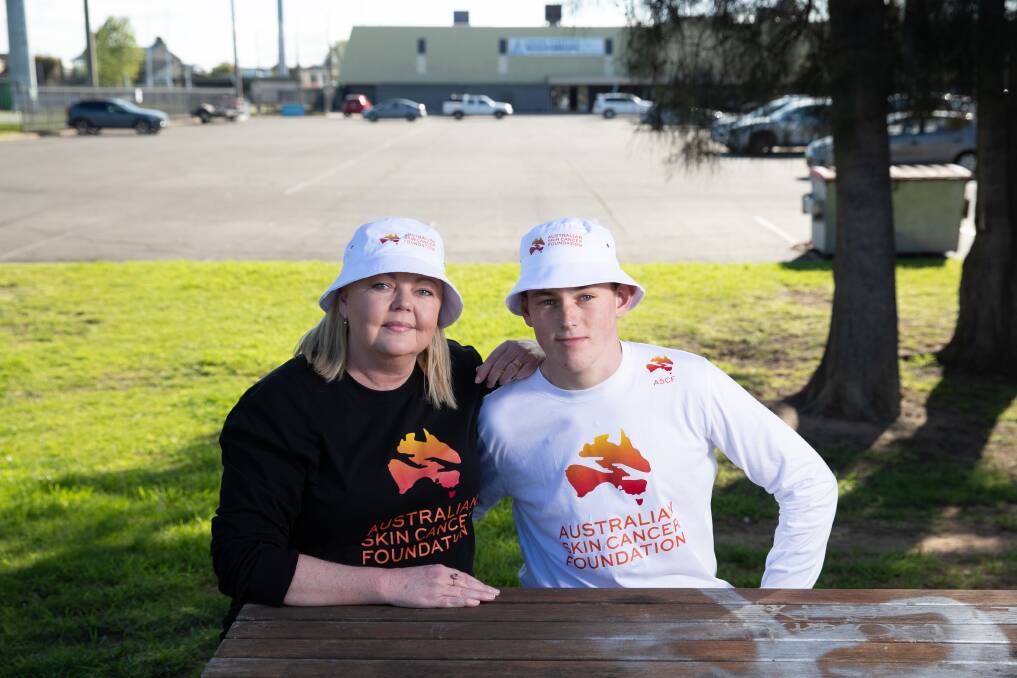  Wagga's Kylie Manson, who has stage four melanoma, with 17-year-old nephew Cooper Manson whose early stage melanoma was detected thanks to his aunts persistance for him to get checked. Picture by Madeline Begley 