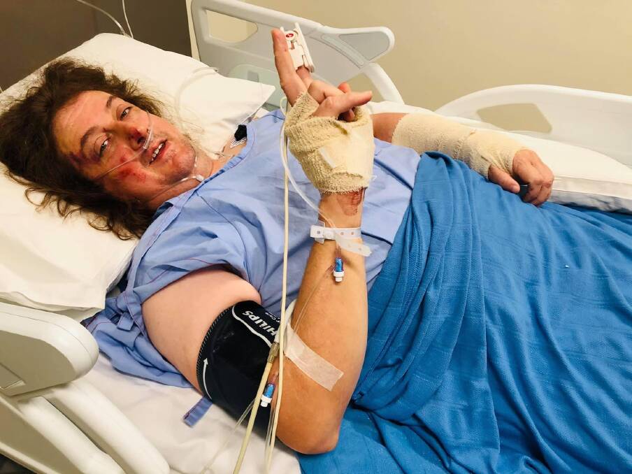 GRATEFUL: Greg McWilliam says he is so thankful to the passersby and the emergency services who helped him after he crashed into a tree. Picture: Supplied 