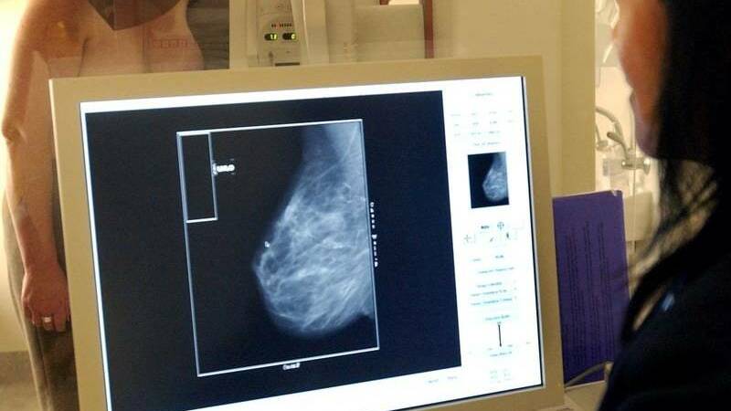 Just taking 20 minutes for a breast check 'can save a life'