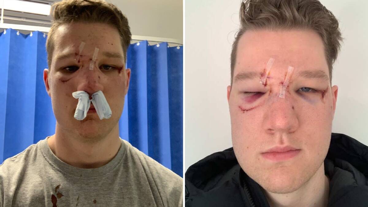 In the latest string of violence an officer was assaulted at the Frank Baxter Centre Friday, while at Cobham on Saturday an officer suffered a broken nose, eye socket and concussion after being punched eight times by an offender.