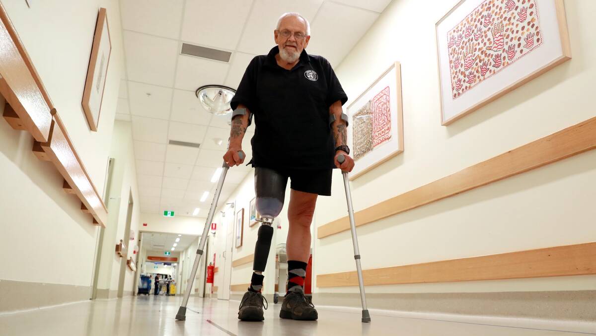 Don Beale of Wagga with his new prosthesis.