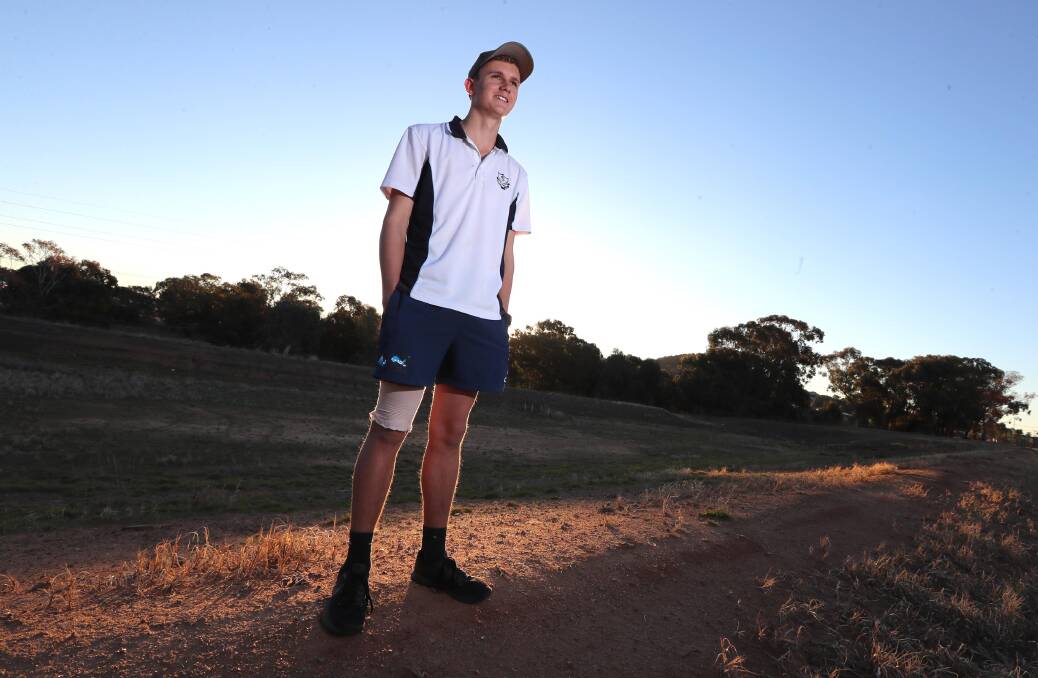 SWIFT RECOVERY: Sam Carmichael has made a good recovery from a burn he suffered after a motorcycle crash on the family farm just seven weeks ago. Picture: Les Smith