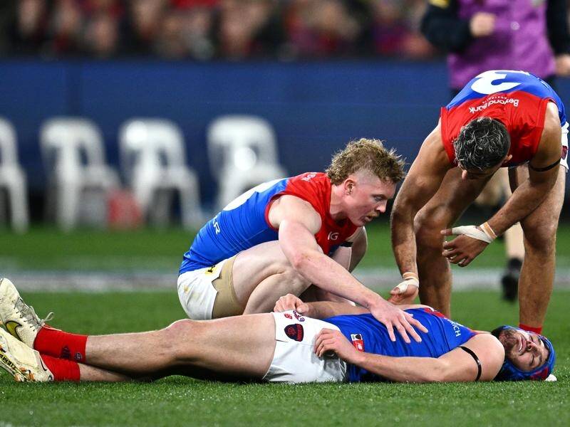 Melbourne player Angus Brayshaw was forced to retire from the AFL after a series of head knocks. (Joel Carrett/AAP PHOTOS)