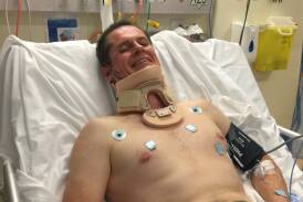 Dubbo mayor Mathew Dickerson has three fractured vertebra, a slightly strained AC joint and four stiches in his right ear after crashing his bike. Photo: CONTRIBUTED