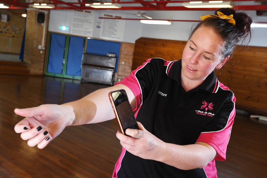 SKIN SMART: Amanda Hubbard, who is involved in the Amie St Clair Melanoma Trust, is excited to see how the new DermEngine app can help Wagga residents.